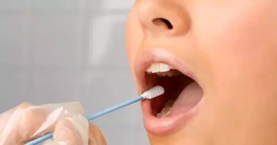 亲子鉴定口腔拭子取样方法